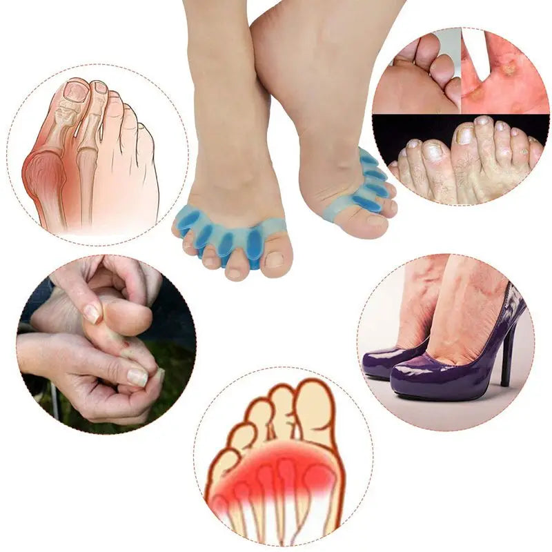 Gel Toe Separators – Bunion Corrector & Foot Care